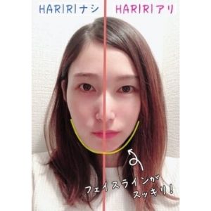 たるみ、ほうれい線対策の「シール」が凄すぎと話題