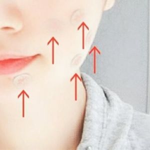 【在宅中セルフケア！】外出なしで美容鍼ができちゃう！？